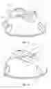 Fig. 09 - Systems and methods for radiographically identifying an access port