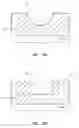 Fig. 35 - Systems and methods for radiographically identifying an access port