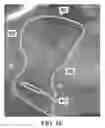 Fig. 16 - Softening nerve cuff electrodes
