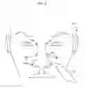 Fig. 05 - Sinus treatment device with enhanced tip