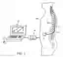 Fig. 04 - Systems and methods of providing modulation therapy without patient-perception of stimulation