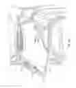 Fig. 22 - IMPLANTABLE NASAL STIMULATOR SYSTEMS AND METHODS