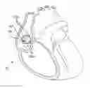 Fig. 01 - Current steering to achieve spatial selectivity for his bundle pacing