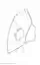 Fig. 09 - Valve structure for respirator