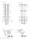 Fig. 03 - PILATES MAT WITH ADJUSTABLE ISCHIAL TUBEROSITY SUPPORT