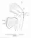 Fig. 45 - Golf club head
