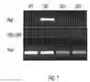 Fig. 08 - Tobacco plants with reduced nicotine production by suppressing transcriptional factor Myc