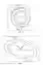 Fig. 06 - Cleaning product comprising an inverted container assembly and a viscous cleaning composition
