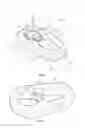Fig. 03 - Link with swivel ball bushing rotatable in opposing directions