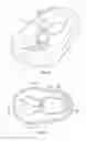Fig. 09 - Link with swivel ball bushing rotatable in opposing directions
