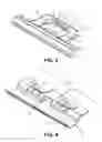 Fig. 04 - Gasket retention system