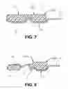 Fig. 07 - Gasket retention system