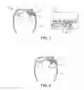 Fig. 02 - HEAD MOUNTED DEVICE COMPRISING A FOURIER HOLOGRAM