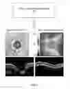 Fig. 02 - Glaucoma diagnosis method using fundus image and apparatus for the same