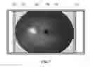 Fig. 07 - Glaucoma diagnosis method using fundus image and apparatus for the same