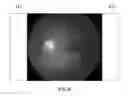 Fig. 08 - Glaucoma diagnosis method using fundus image and apparatus for the same