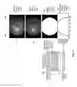 Fig. 09 - Glaucoma diagnosis method using fundus image and apparatus for the same