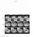 Fig. 07 - Method for processing X-ray computed tomography image using neural network and apparatus therefor
