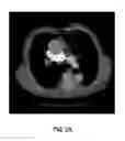 Fig. 04 - Anatomy segmentation through low-resolution multi-atlas label fusion and corrective learning