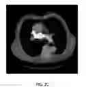 Fig. 06 - Anatomy segmentation through low-resolution multi-atlas label fusion and corrective learning