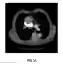 Fig. 07 - Anatomy segmentation through low-resolution multi-atlas label fusion and corrective learning