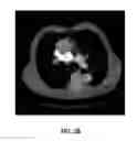 Fig. 08 - Anatomy segmentation through low-resolution multi-atlas label fusion and corrective learning