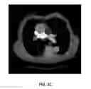 Fig. 09 - Anatomy segmentation through low-resolution multi-atlas label fusion and corrective learning