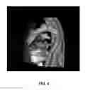 Fig. 10 - Anatomy segmentation through low-resolution multi-atlas label fusion and corrective learning