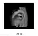 Fig. 12 - Anatomy segmentation through low-resolution multi-atlas label fusion and corrective learning