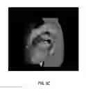 Fig. 13 - Anatomy segmentation through low-resolution multi-atlas label fusion and corrective learning