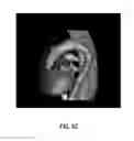 Fig. 16 - Anatomy segmentation through low-resolution multi-atlas label fusion and corrective learning