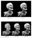 Fig. 03 - Hybrid interactive mode for rendering medical images with ray tracing