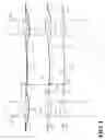 Fig. 02 - Strand support device