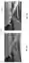 Fig. 12 - Rolling shutter correction for images captured by a camera mounted on a moving vehicle