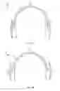 Fig. 02 - Foldable headphones