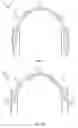 Fig. 02 - Synchronized telescoping headphones