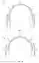 Fig. 02 - Low spring-rate band