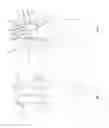 Fig. 02 - Garmet provided with an inflatable protective device