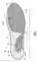 Fig. 07 - Particulate foam in coated carrier