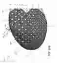 Fig. 17 - Sole structure for article of footwear