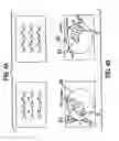Fig. 05 - Apparatus and Method for Four Dimensional Soft Tissue Navigation Including Endoscopic Mapping