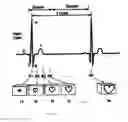 Fig. 10 - Apparatus and Method for Four Dimensional Soft Tissue Navigation Including Endoscopic Mapping