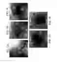 Fig. 02 - Device and method for enhanced visualization of the small intestine