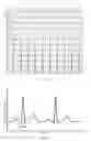 Fig. 02 - Automatic method to delineate or categorize an electrocardiogram