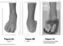 Fig. 07 - System and method for identifying physical properties of feet