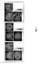 Fig. 08 - Automated, objective method of assessing tinnitus condition