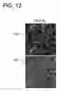 Fig. 15 - Quantitative differentiation of tumor heterogeneity using diffusion MR imaging data