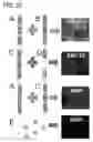 Fig. 24 - Quantitative differentiation of tumor heterogeneity using diffusion MR imaging data