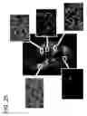 Fig. 26 - Quantitative differentiation of tumor heterogeneity using diffusion MR imaging data