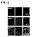 Fig. 47 - Quantitative differentiation of tumor heterogeneity using diffusion MR imaging data